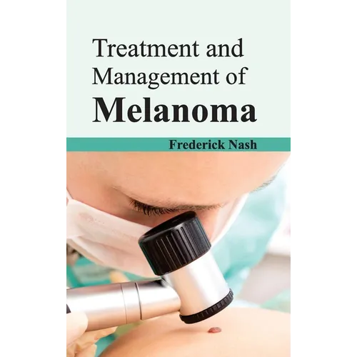 Treatment and Management of Melanoma