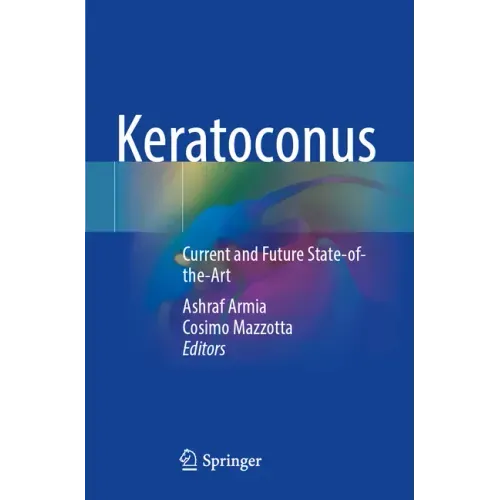 Keratoconus: Current and Future State-Of-The-Art