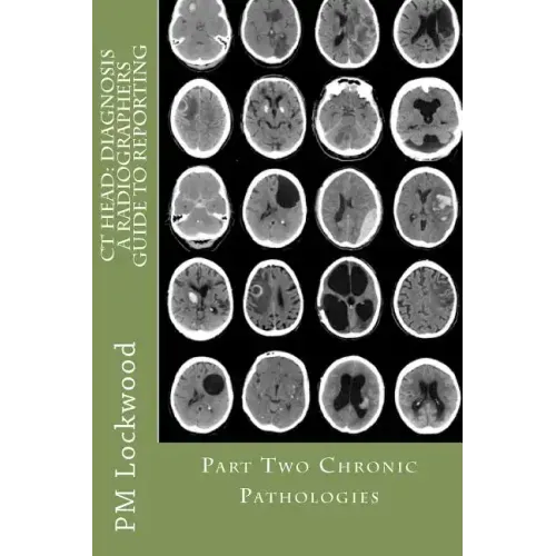 CT Head: DIAGNOSIS A Radiographers Guide To Reporting Part 2 Chronic Pathologies: Part 2 Chronic Pathologies