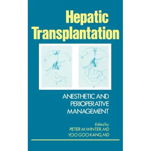 Hepatic Transplantation: Anesthetic and Perioperative Management