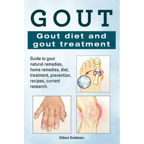 Gout. Gout diet and gout treatment. Guide to gout natural remedies, home remedies, diet, treatment, prevention, recipes, current research.