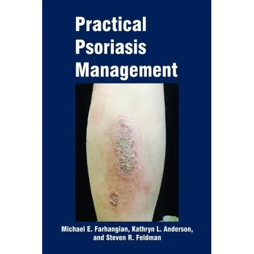 Practical Psoriasis Management