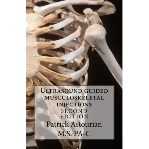 Ultrasound guided musculoskeletal injections