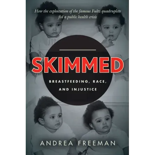 Skimmed: Breastfeeding, Race, and Injustice