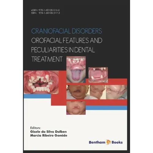 Craniofacial disorders - orofacial features and peculiarities in dental treatment
