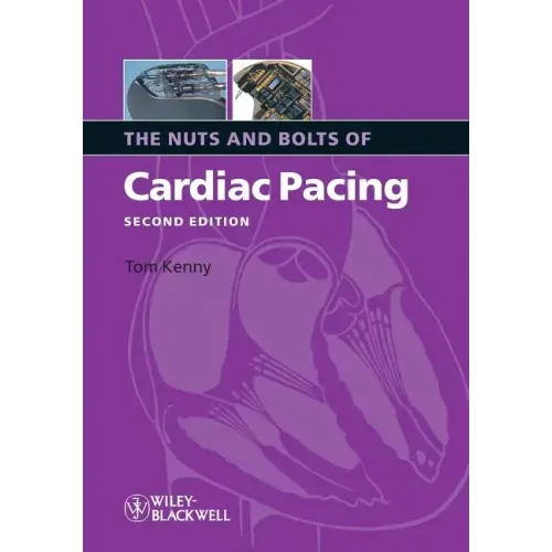 Nuts Bolts Cardiac Pacing 2e
