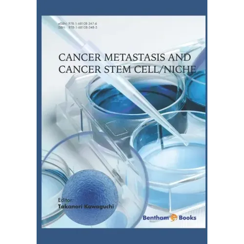 Cancer Metastasis and Cancer Stem Cell/Niche