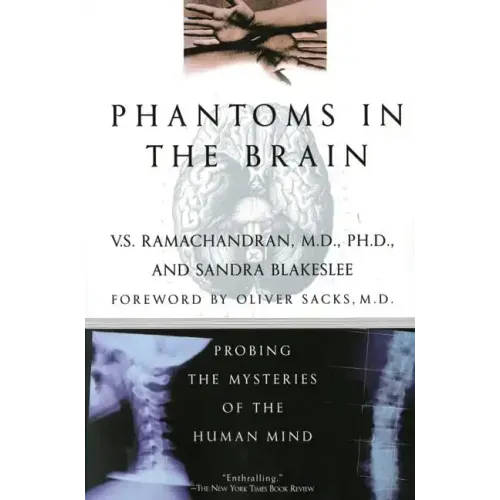 Phantoms in the Brain