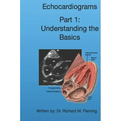 Echocardiograms - Part 1: Understanding the Basics.