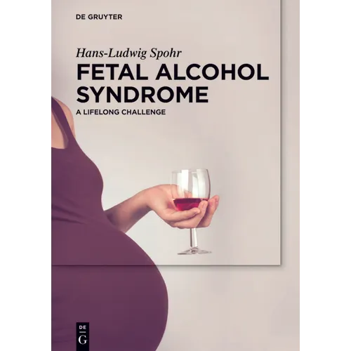 Fetal Alcohol Syndrome: A Lifelong Challenge - Hardcover