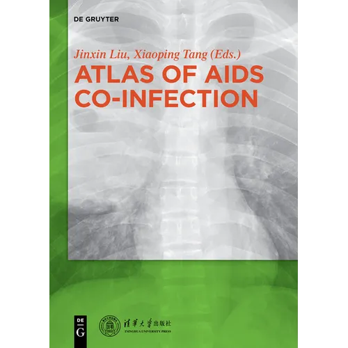 Atlas of AIDS Co-Infection