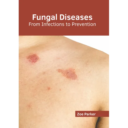 Fungal Diseases: From Infections to Prevention