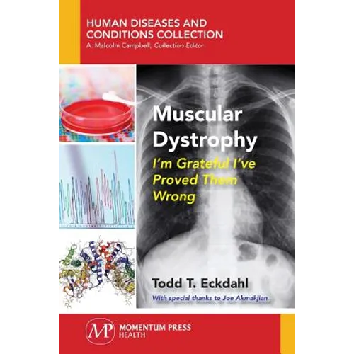 Muscular Dystrophy: I'm Grateful I've Proved Them Wrong