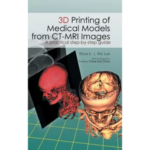 3D Printing of Medical Models from CT-MRI Images: A Practical step-by-step guide - Hardcover