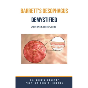 Barretts Oesophagus Demystified: Doctor's Secret Guide - Paperback