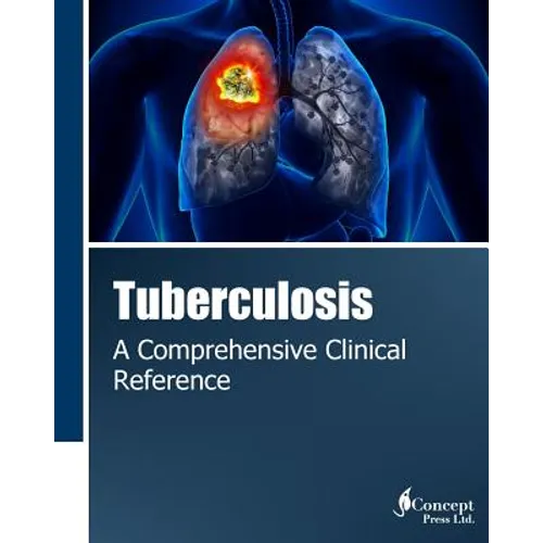 Tuberculosis: A Comprehensive Clinical Reference