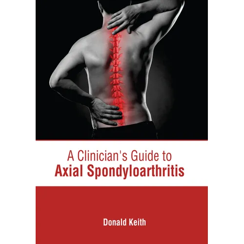 A Clinician's Guide to Axial Spondyloarthritis