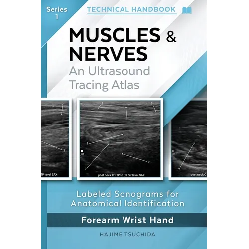Technical Ultrasound Handbook - Muscles & Nerves: An Ultrasound Tracing Atlas (Series 1)