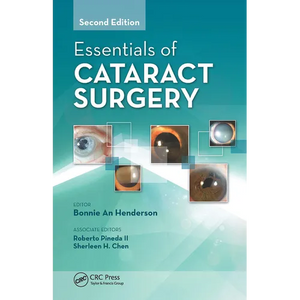 Essentials of Cataract Surgery - Paperback
