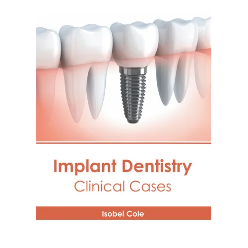 Implant Dentistry: Clinical Cases