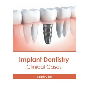 Implant Dentistry: Clinical Cases - Hardcover