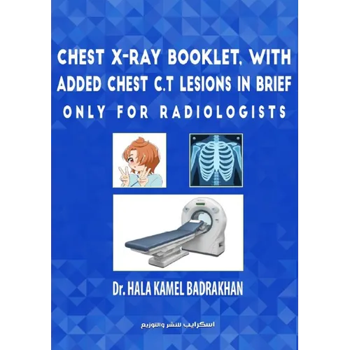 Chest X-Ray Booklet, with added Chest C.T Lesions in brief Only for Radiologists
