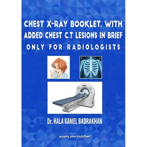 Chest X-Ray Booklet, with added Chest C.T Lesions in brief Only for Radiologists - Paperback