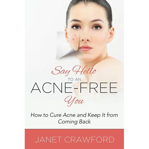 Say Hello to an Acne-Free You: How to Cure Acne and Keep It from Coming Back