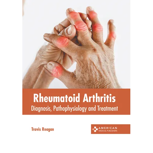Rheumatoid Arthritis: Diagnosis, Pathophysiology and Treatment