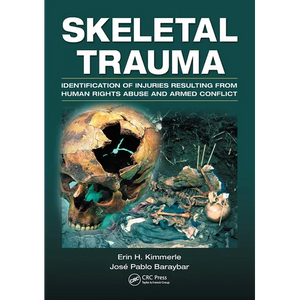 Skeletal Trauma: Identification of Injuries Resulting from Human Rights Abuse and Armed Conflict - Paperback
