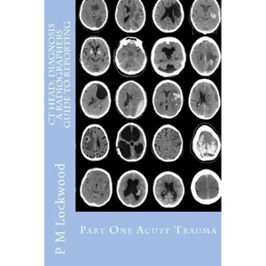 CT Head: DIAGNOSIS A Radiographers Guide To Reporting Part 1 Acute Trauma: Part One Acute Trauma - Paperback