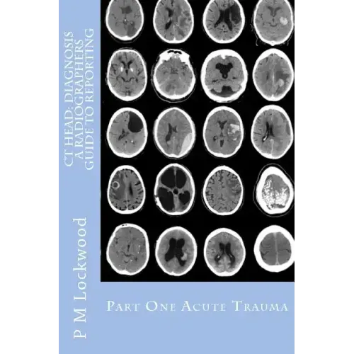 CT Head: DIAGNOSIS A Radiographers Guide To Reporting Part 1 Acute Trauma: Part One Acute Trauma