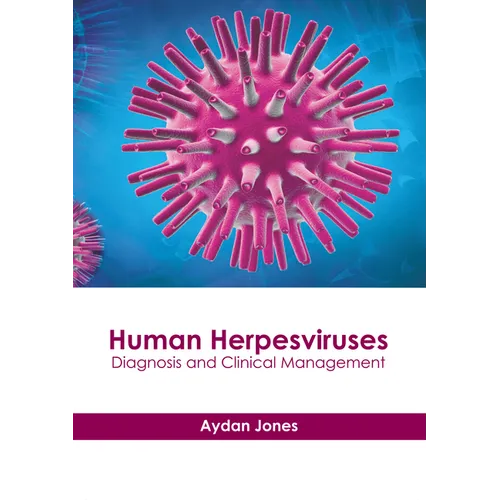 Human Herpesviruses: Diagnosis and Clinical Management