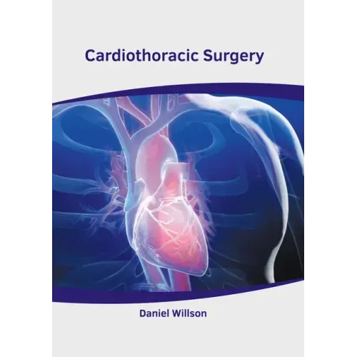 Cardiothoracic Surgery