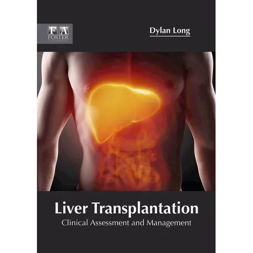 Liver Transplantation: Clinical Assessment and Management