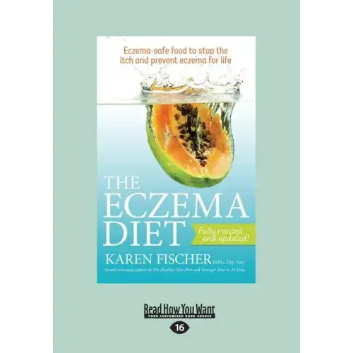 The Eczema Diet: Eczema-Safe Food to Stop the Itch and Prevent Eczema for Life (Large Print 16pt)