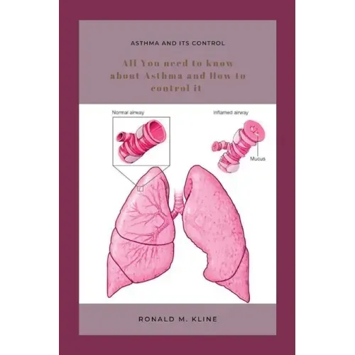 Asthma and its control: All you need to know about Asthma and how to control it.