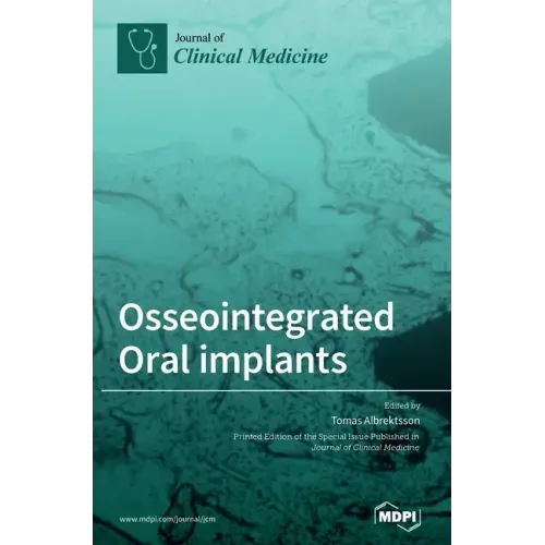 Osseointegrated Oral implants: Mechanisms of Implant Anchorage, Threats and Long-Term Survival Rates