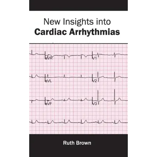 New Insights Into Cardiac Arrhythmias