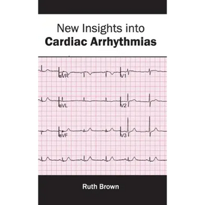 New Insights Into Cardiac Arrhythmias - Hardcover