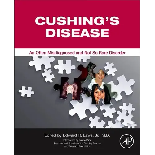 Cushing's Disease: An Often Misdiagnosed and Not So Rare Disorder