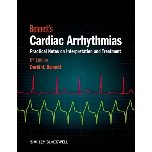 Cardiac Arrhythmias 8e
