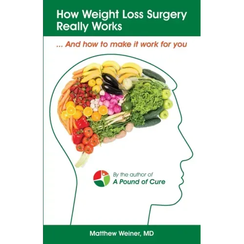 How Weight Loss Surgery Really Works: And How to Make it Work for You