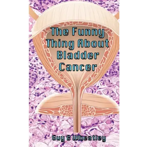 The Funny Thing About Bladder Cancer