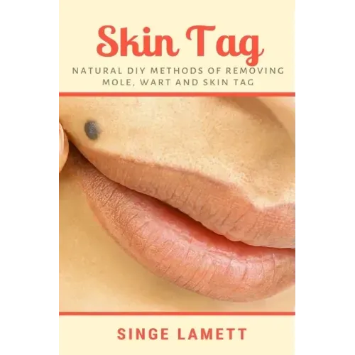 Skin Tag: Natural DIY Methods of removing Mole, Wart and Skin Tag