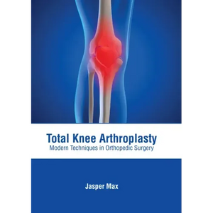 Total Knee Arthroplasty: Modern Techniques in Orthopedic Surgery - Hardcover