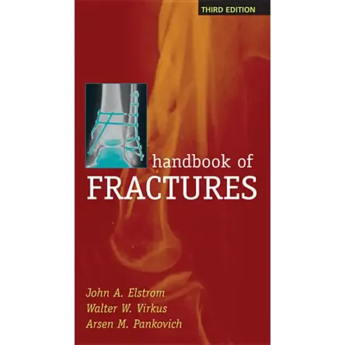 Handbook of Fractures, Third Edition