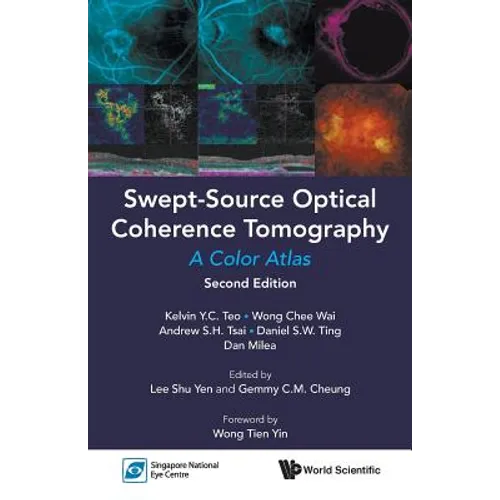 Swept-Source Optic Cohe (2nd Ed)