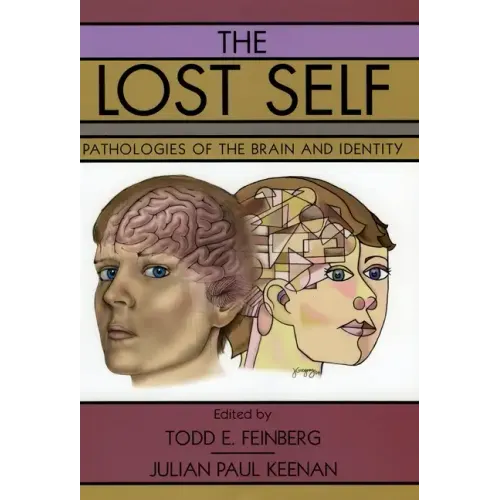 The Lost Self: Pathologies of the Brain and Identity
