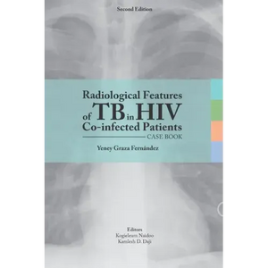 Radiological features of TB in HIV Co-infected Patients. Case book - Paperback
